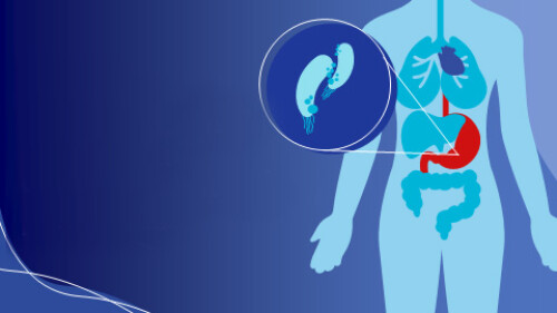 Ефективність ерадикаційної терапії helicobacter pylori при функціональній диспепсії